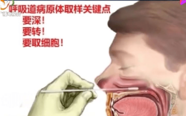 核酸檢測