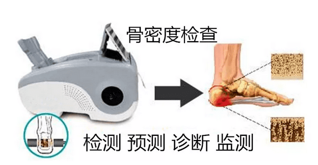 南京科進(jìn)超聲骨密度儀